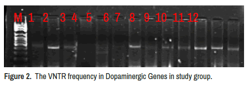 clinical-schizophrenia-dopaminergic-genes