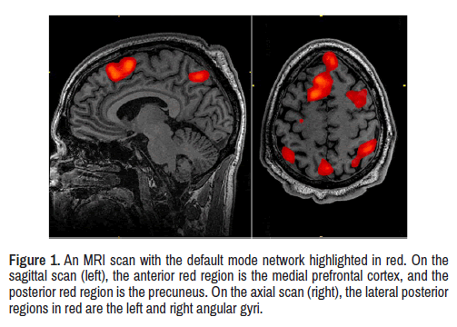 clinical-schizophrenia-prefrontal-cortex